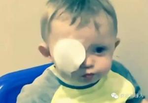 无人机失控 | 英国1岁男童痛失一眼